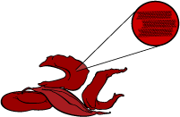Sickle Cell for Healthcare Professionals - Brent Sickle Cell ...
