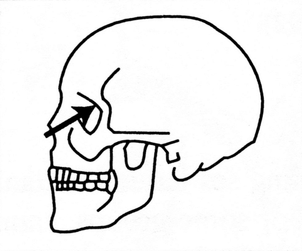 Fill In The Blank Skull Bones - ClipArt Best