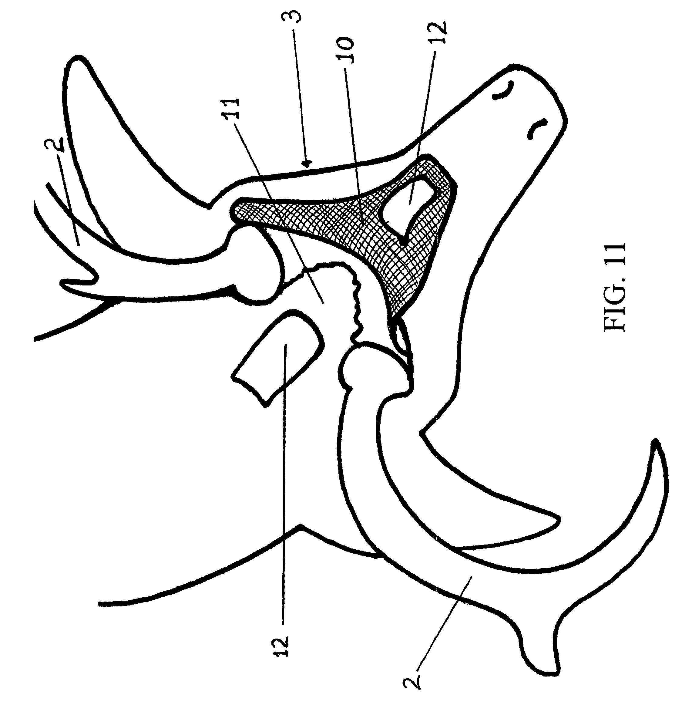 Patent US8162670 - Method of mounting a game animal and kit ...
