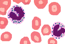 Morphologic Alterations in Neutrophils - Dr Sampurna Roy MD