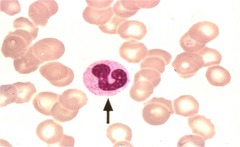 Hematology Lecture 3: Identification LMU flashcards
