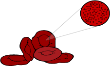 Sickle Cell for Healthcare Professionals - Brent Sickle Cell ...