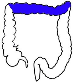 Transverse colon - Wikipedia