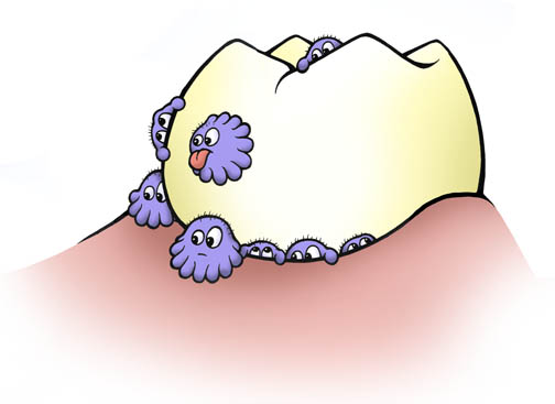 DENTAL CARIES : INTRODUCTION & SYMPTOMS |