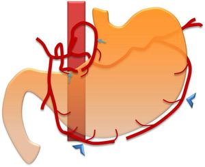 ECR 2014 / C-1003 / “Pushing the envelope!” - Role of MDCT in ...