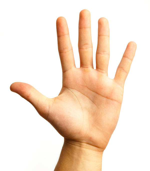 Brown Spots On Palms Of Hands - Doctor answers on HealthTap