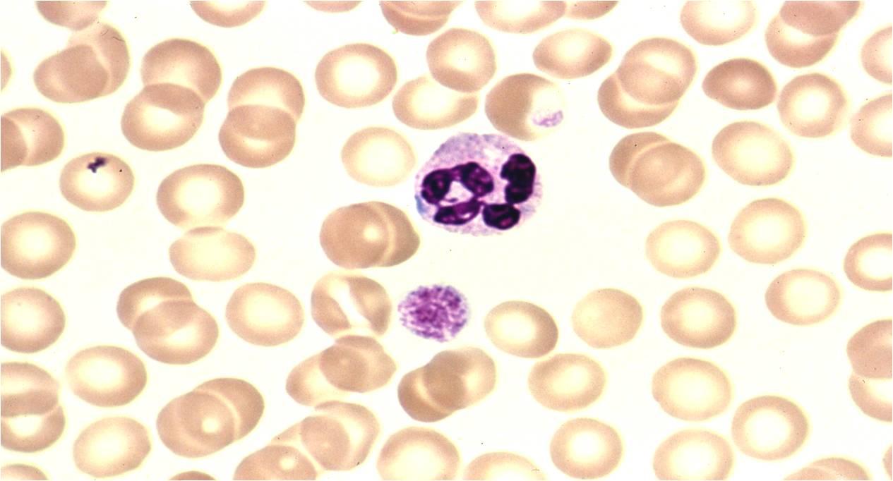 Neutrophil Granulocyte - ClipArt Best