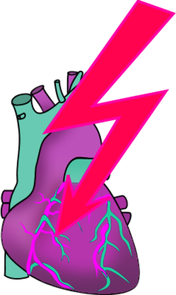 human hear with an electricity bolt signaling a heart attack ...