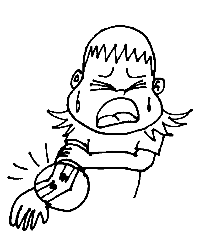 Broken Arm Clipart