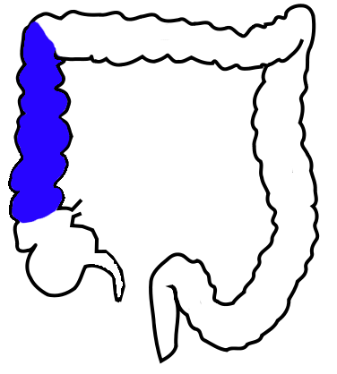Ascending colon - Wikipedia