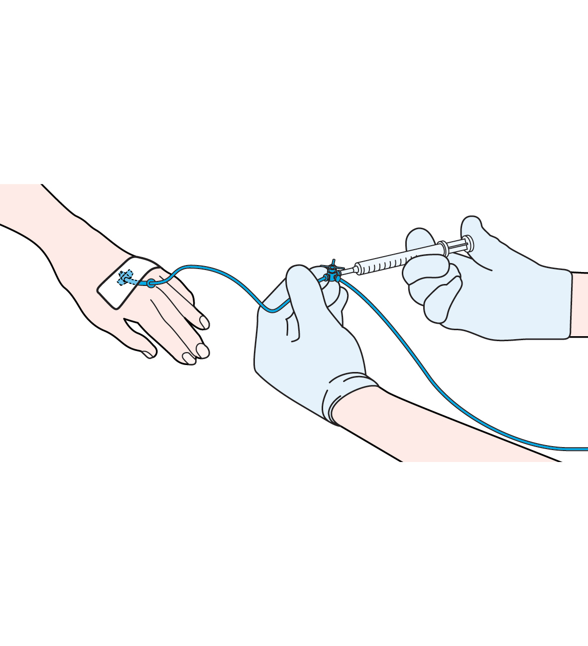 Chemotherapy for non-Hodgkin lymphoma - Cancer Information ...